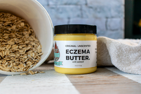 Eczema Butter