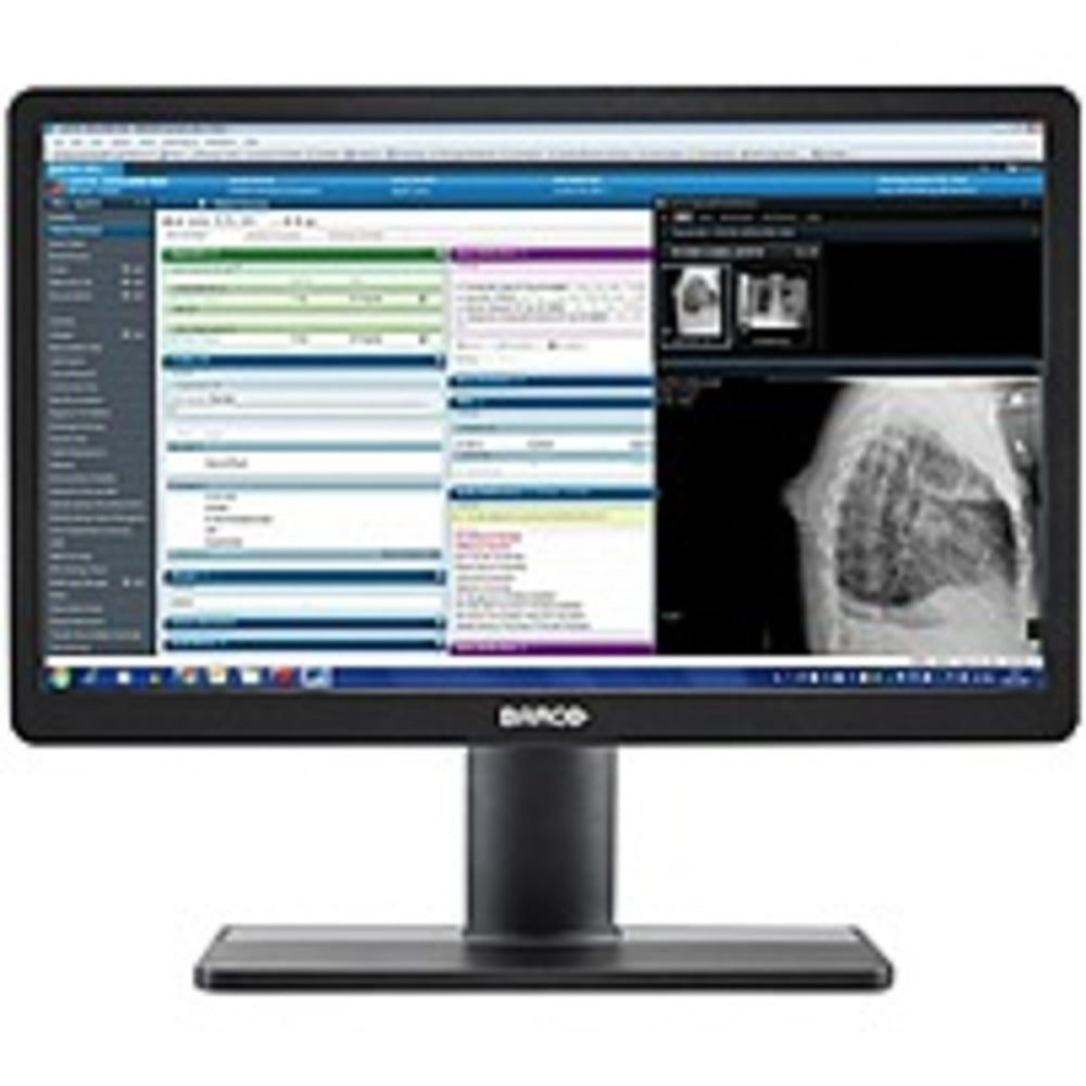 Barco Eonis Mdrc-2222 Option Bl 21.5 Full Hd Led Lcd Monitor - 16:9 - Black - 1920 X 1080 - 1.07 Billion Colors - 300 Nit - 7.50 Ms - Dvi - Monitorport