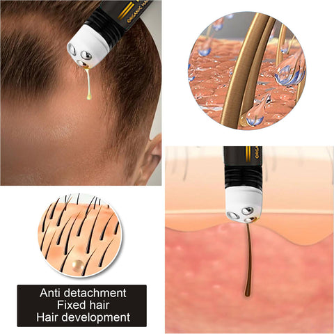 Hair Growth Products Anti Hair Loss Essential Oil Head Massage Scalp Treatments Natural Health Beauty Care