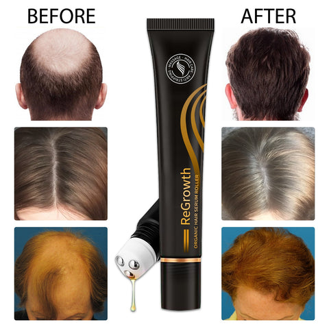 Hair Growth Products Anti Hair Loss Essential Oil Head Massage Scalp Treatments Natural Health Beauty Care